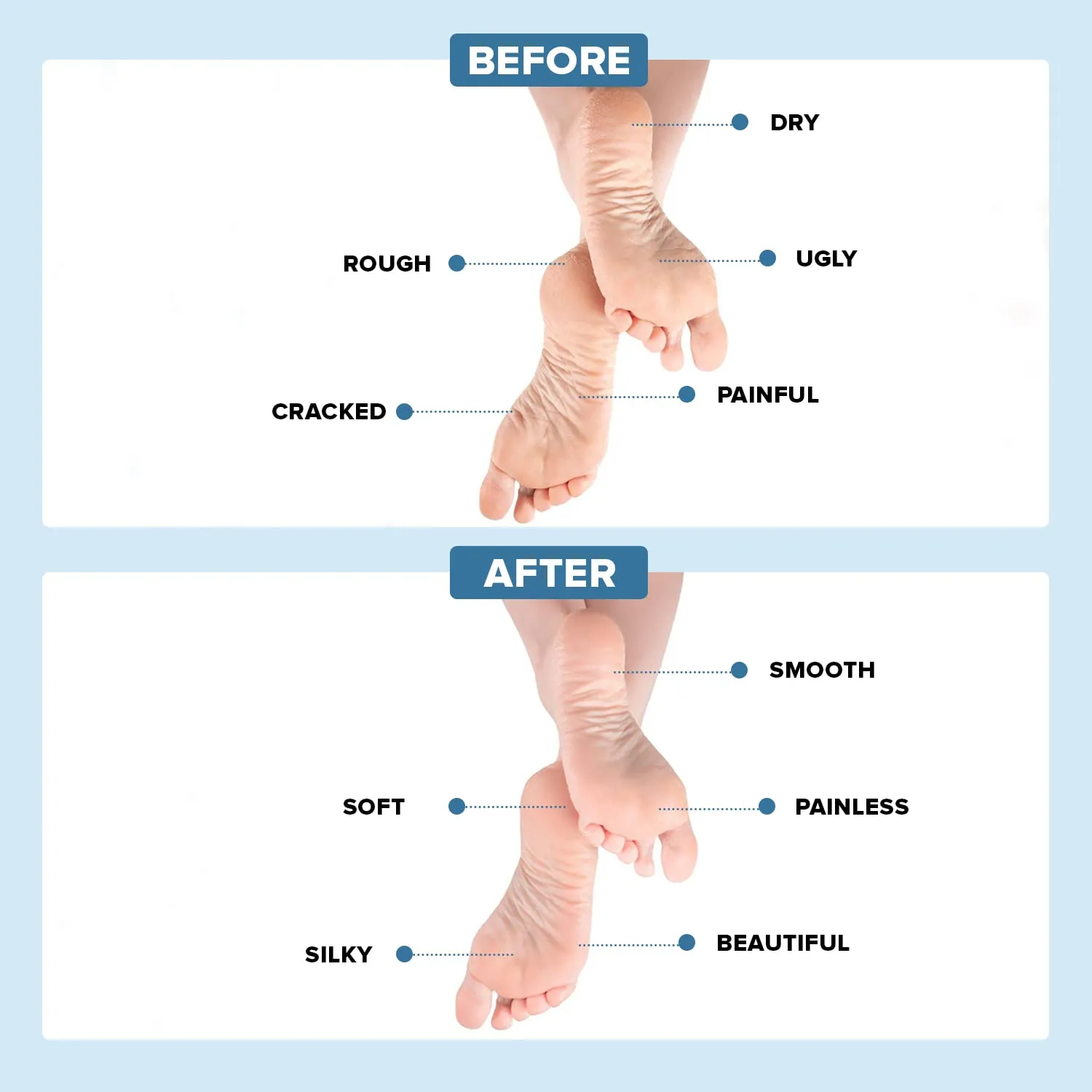 Dr Foot Silicone Gel Heel Socks | Silicone Gel Moisturizer Heel Sleeves To Smooth & Soften Rough Cracked Heels & Dry Feet Or Irritated Heels| For Men & Women | Free Size – 1 Pair (Pack of 5)