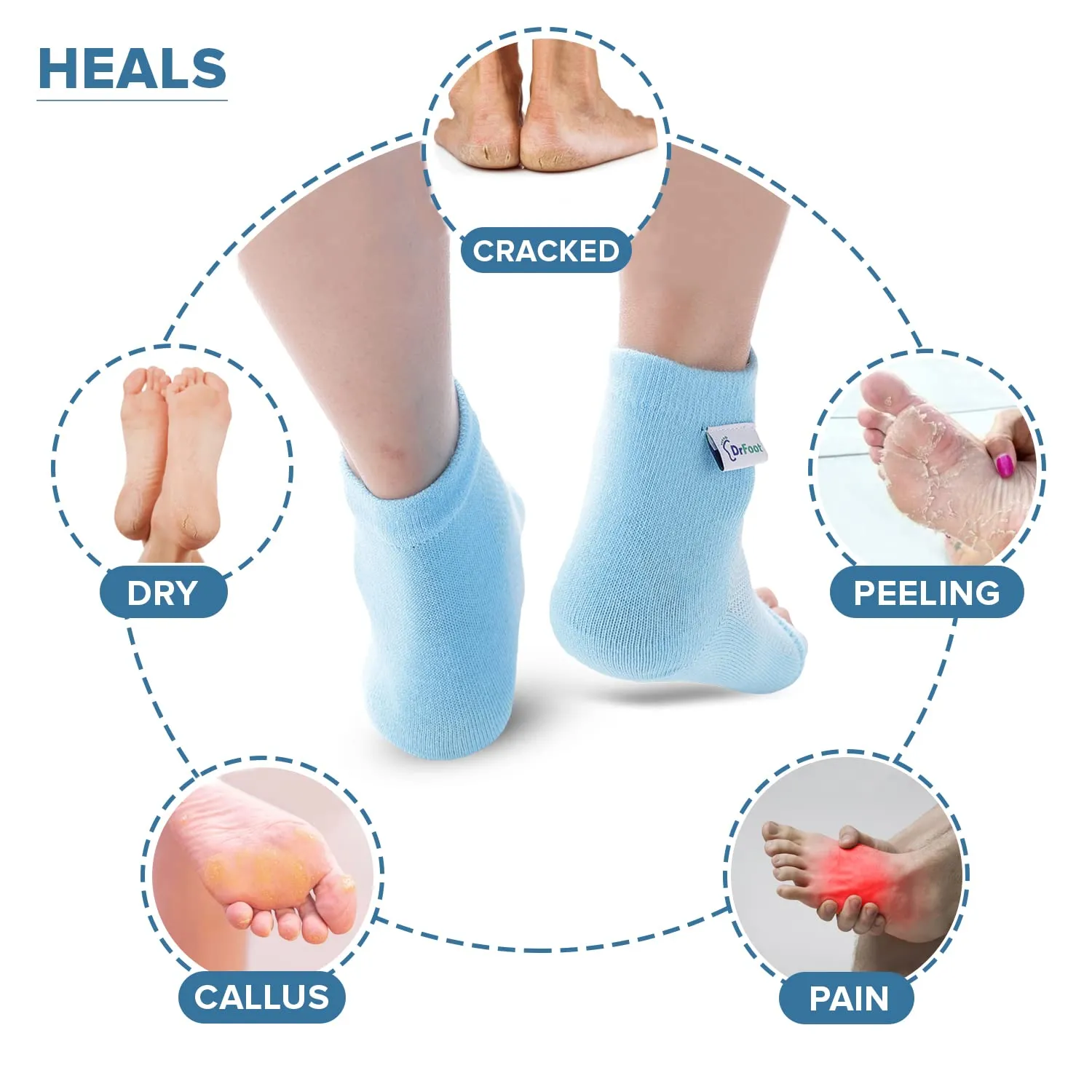 Dr Foot Silicone Gel Heel Socks | Silicone Gel Moisturizer Heel Sleeves To Smooth & Soften Rough Cracked Heels & Dry Feet Or Irritated Heels| For Men & Women | Free Size – 1 Pair (Pack of 5)
